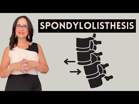 #057 Dr. Furlan Reveals the 5 Questions You Need to Know About Spondylolisthesis