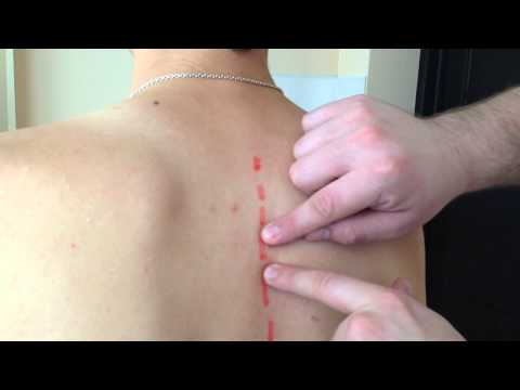 Как поставить позвонки на место?