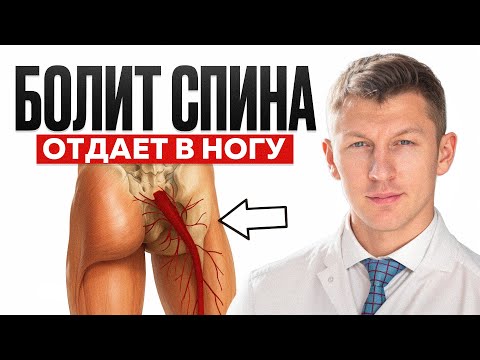 СТРАШНЫЙ СИМПТОМ из-за которого ноги откажут! / Как убрать боль в спине?