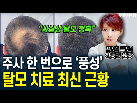 '죽은 모발이란 건 없었습니다' 진료 한 번으로 끝나는 탈모 치료 최신 근황