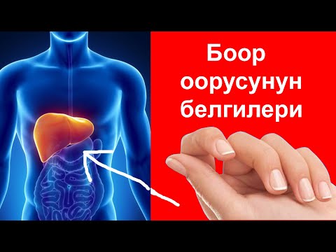 Боор оорусунун белгилери. Боор ооруп жатканын кантип билиш керек?