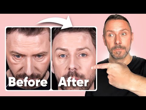 EYE BAGS. MALAR BAGS. FESTOONS. AND HOW TO COVER THEM UP INSTANTLY!