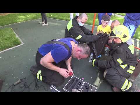 Moscow firefighters saved a child's hand.