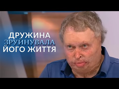 Дружина облила чоловіка бензином, ПІДПАЛИЛА та втекла! "Говорить Україна". Архів