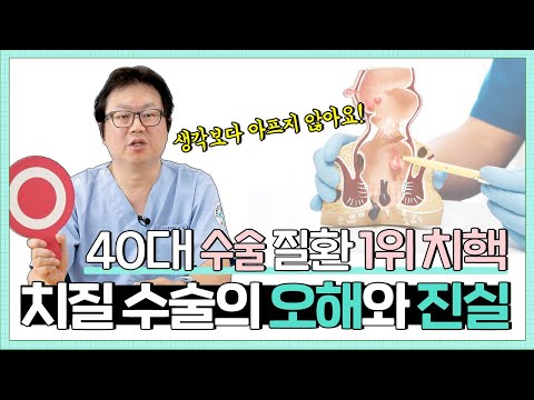 [치핵] 치질에 대한 오해와 진실 | 치질수술 생각보다 안 아픕니다