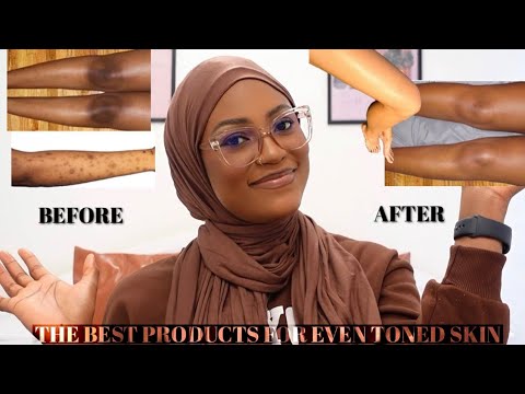 THE BEST BODY CARE PRODUCTS FOR SMOOTH & EVEN SKIN TONE ||CLEARING BODY HYPERPIGMENTATION AND ACNE