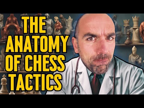 Master the Art of Removing the Defender (Chess Tactics Exposed)