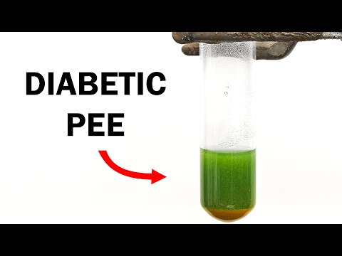 Recreating the world's first test for diabetes