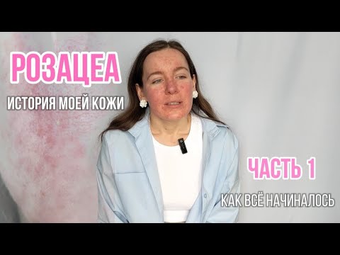 РОЗАЦЕА. ИСТОРИЯ МОЕЙ КОЖИ. ЧАСТЬ 1: КАК ВСЁ НАЧАЛОСЬ 