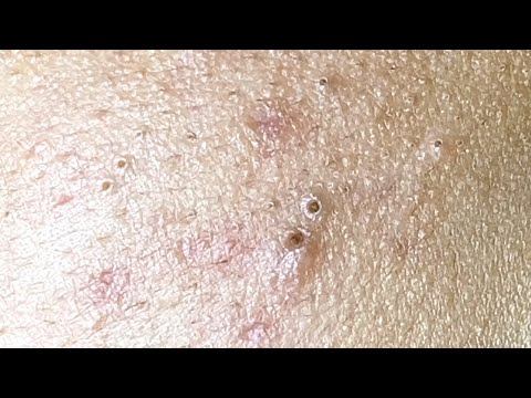 Relax Every Day With Sac Dep Spa #0116