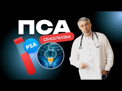 PSA testing: who, when, and how to get it. What to do with the results?