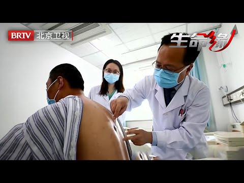 50岁男子脊椎塞满肿瘤，半小时出血超全身三分之一，血袋挂满天花板，所有医生不敢再动刀【生命缘第12季】