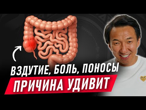 One in seven people suffers from THIS DISORDER... / Irritable bowel syndrome / #doctorzimba