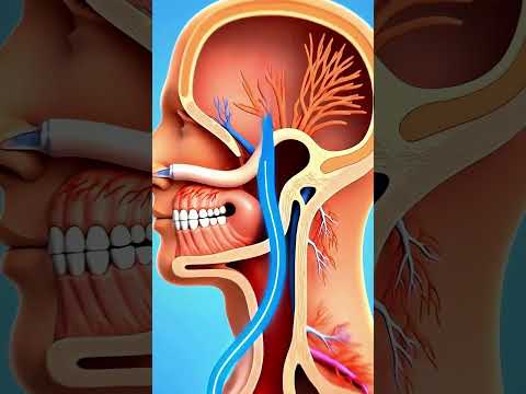 The Reason You Shouldn't Hold A Sneeze 😯