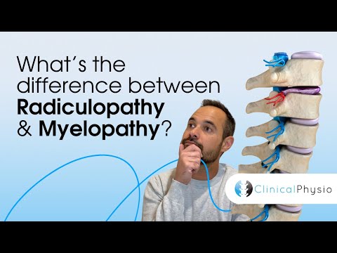 What’s the difference between Radiculopathy and Myelopathy? | Expert Physio Guide