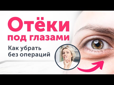 СКРЫТЫЕ причины МЕШКОВ под глазами. Как убрать без пластики?