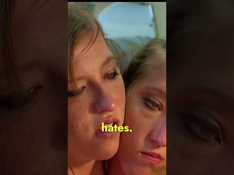 Conjoined Twins Get Their Nails Done Together 💅