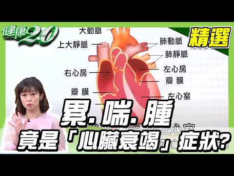 累喘腫竟是「心臟衰竭」症狀？心臟要有力，趕快練握力！健康2 0 完整版