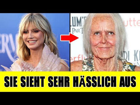 8 deutsche Prominente, die vom Ozempic Face betroffen sind – Du wirst schockiert sein!