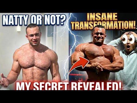He Gained 24lbs in 90 Days... The Truth About Genetic Anomaly