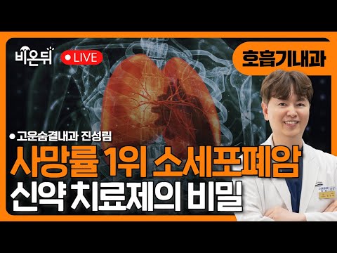 소세포폐암 치료의 혁신을 이룬 신약 / 고운숨결내과 진성림