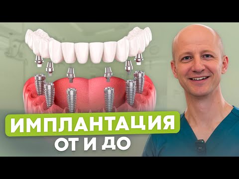 ВСЯ ПРАВДА о том, как проходит ИМПЛАНТАЦИЯ ЗУБОВ!