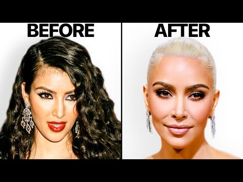 What Happened to Kim Kardashian's Face? | Plastic Surgery Analysis