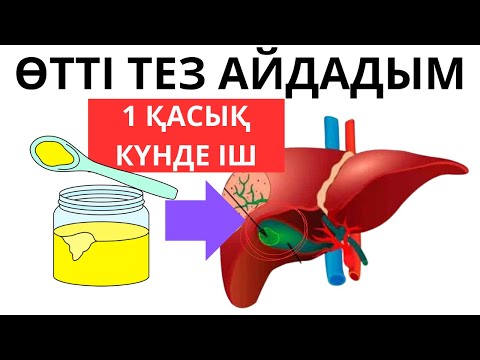 Өтің бөлінуін жақсартуға арналған 5 тағам. Өт толғанда не істеу керек