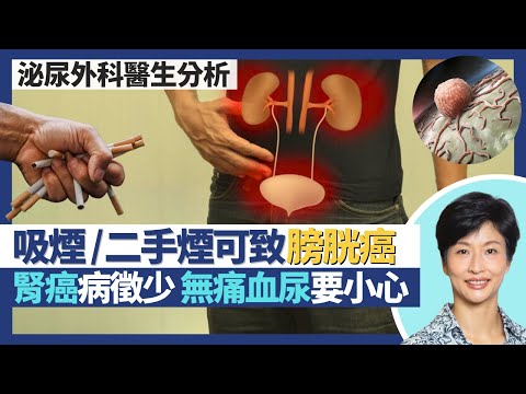 腎癌+膀胱癌(泌尿系統癌症)|膀胱癌最大成因是吸煙 二手煙亦可致病!腎癌膀胱癌病徵少 血尿而無痛楚或是腫瘤先兆!一種中藥成份可致輸尿管癌|王建芳醫生 泌尿外科醫生徐學良醫生|人類健康研究所