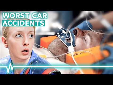 Worst Car Accidents Doctors Have Ever Seen