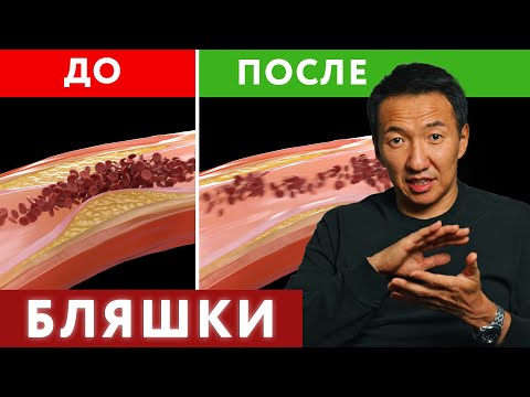 Will this help in the prevention of PLAQUES IN VESSELS? #doctorzimba