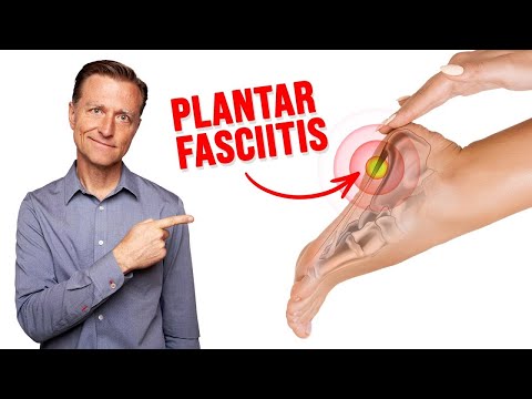 Fix Plantar Fasciitis Instantly (NO MORE HEEL PAIN!)