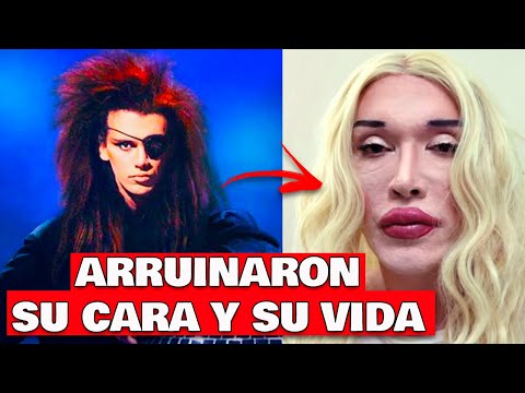 El día que MURIÓ Pete Burns - Biografía del músico ADICT0 a las cirugías