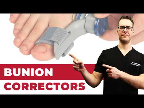 Do Bunion Correctors Work? [How To SHRINK Bunions Naturally!]