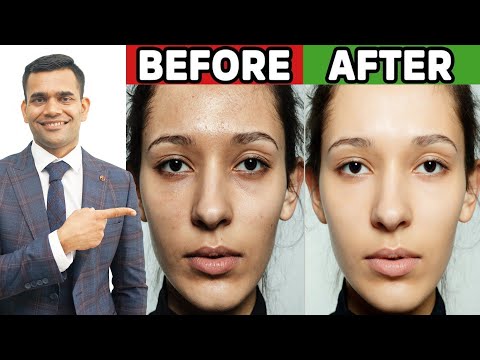 चहरे को बेदाग और सुंदर बनाए | For Clear Glowing Spotless Skin - Dr. Vivek Joshi
