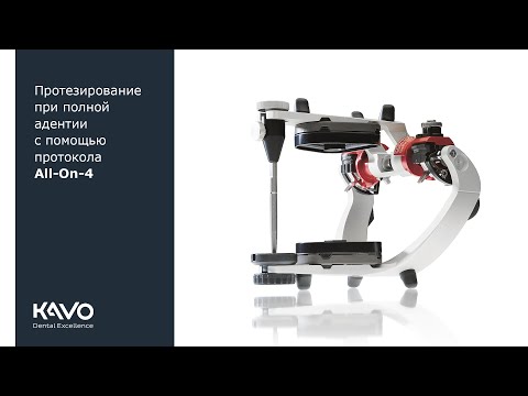 Протезирование при полной адентии с помощью протокола All-On-4