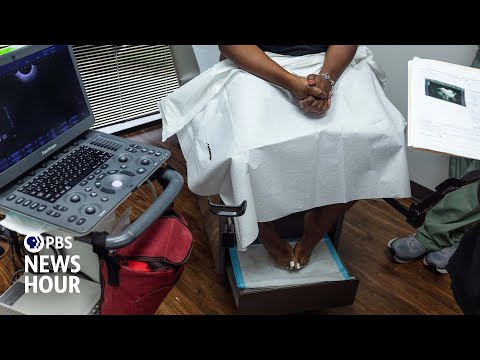 Infant mortality spiked in Texas after abortion ban, study reveals