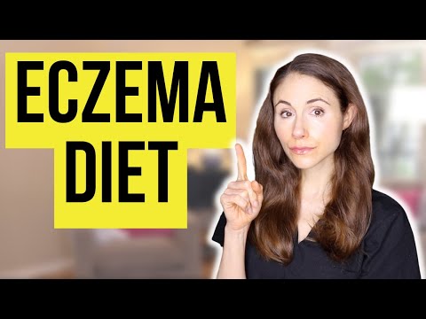 Eczema Diet: What Foods To Avoid For Clear Skin