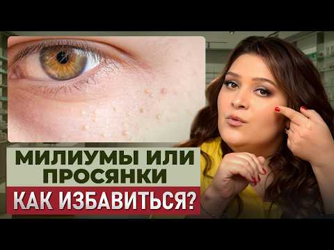 Как БЫСТРО убрать МИЛИУМЫ на лице в домашних условиях? Как ИЗБАВИТЬСЯ от белых точек
