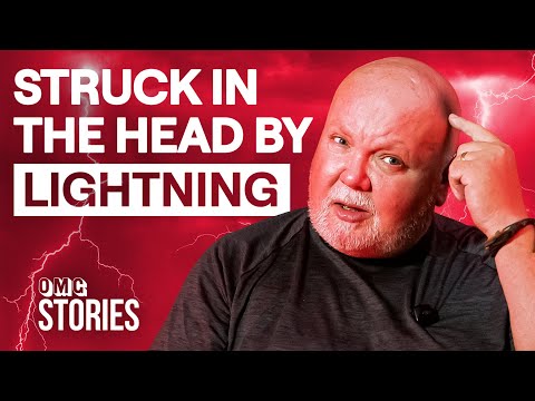 I Survived Being Struck In The Head By Lightning | OMG Stories