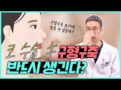 [코성형] 코수술 후 구형구축 반드시 생긴다??
