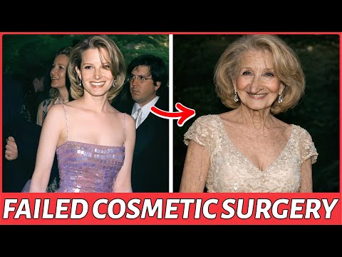 35 Beautiful Hollywood Actresses Ruined by Plastic Surgery