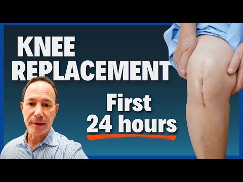 What REALLY Happens After Knee Replacement Surgery