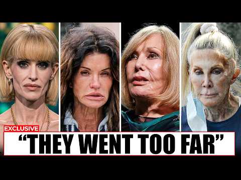 50+ Celeb Face Transformations That Went Too Far | Then and Now Photos 2026