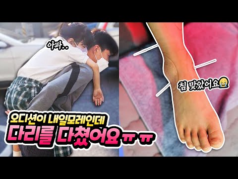 오디션이 내일모레인데 다리를 다쳤어요 ㅠㅠ 유니는 오디션을 무사히 마칠 수 있을까요 ?? 별난가족 일상 브이로그 유니의 성장 스토리 byulnan family