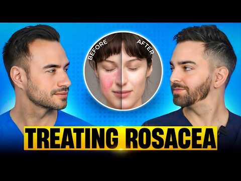 Treat Rosacea Like A Dermatologist