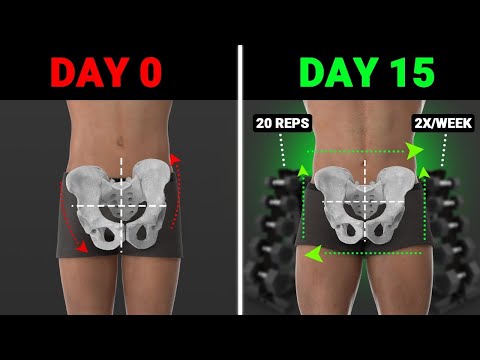 The Best Weight Training Exercises To Fix Lateral Pelvic Tilt (asymmetrical hips)