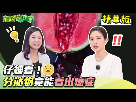 女人下面有臭味原因找到了！陰道分泌物顏色可看出這些事?!女性私密處異味要小心！子宮頸癌vs子宮內膜癌症狀差在哪？哪些人最容易罹癌？｜婦產科 張宇琪醫師｜奕起聊健康 郭奕均｜健康節目｜健康知識｜祝你健康
