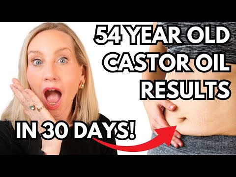 CASTOR OIL Changed My Life in 30 Days Here's How!