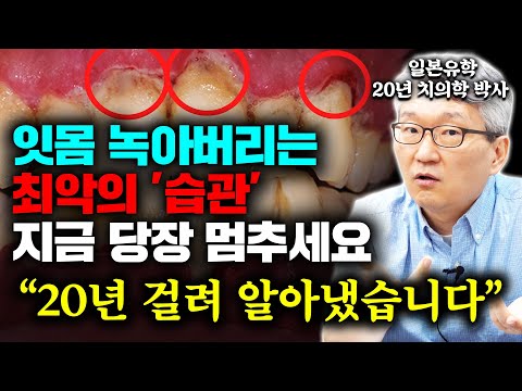 "병든 잇몸 살아납니다" 치아 뿌리 다 드러났을 때 잇몸병 없애는 가장 확실한 방법 (박한성 원장 통합)